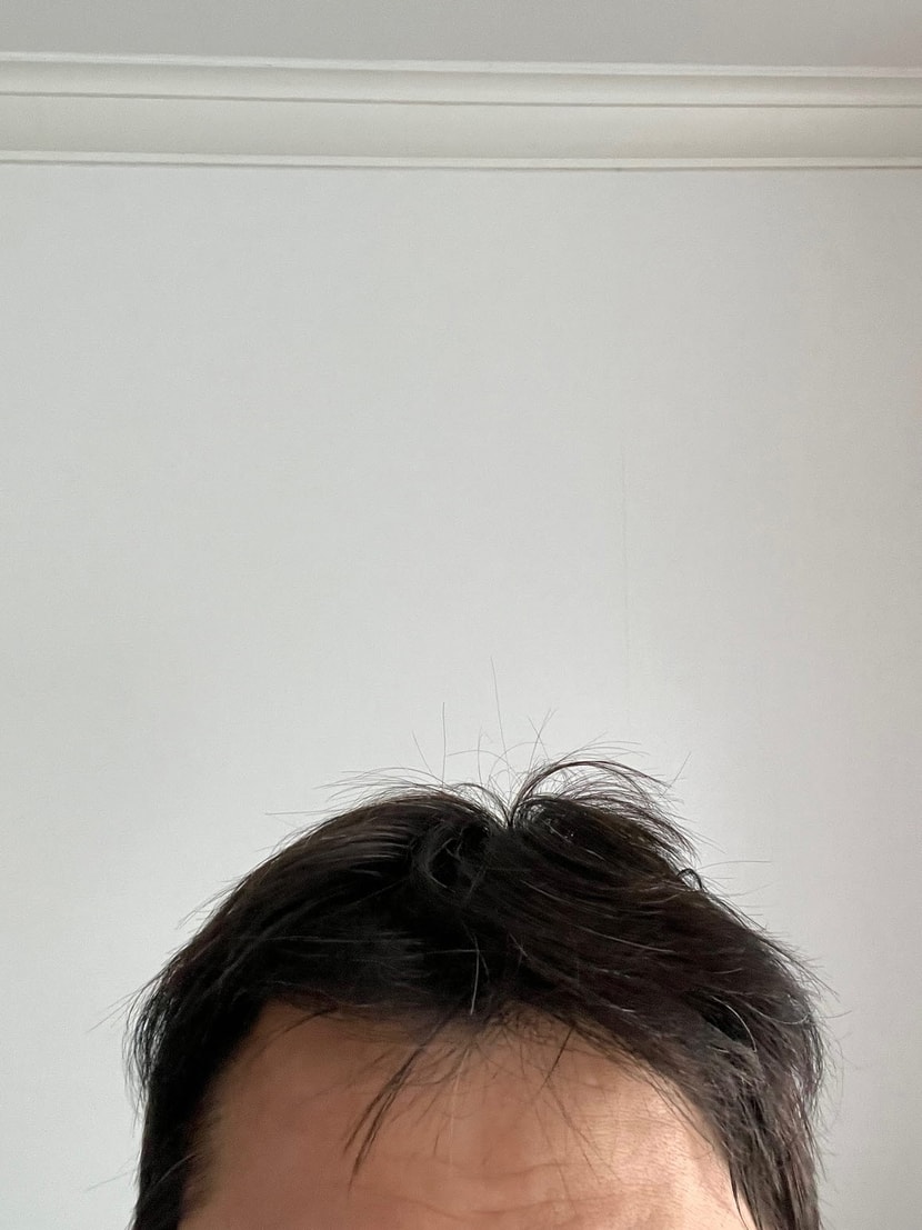 전날 샴푸 후 아침 샴푸 전 사진
