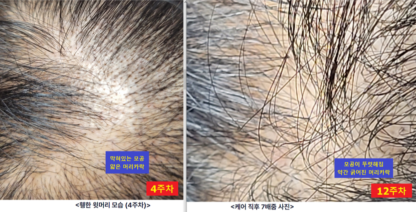 (비교) 4주차 vs 11주차