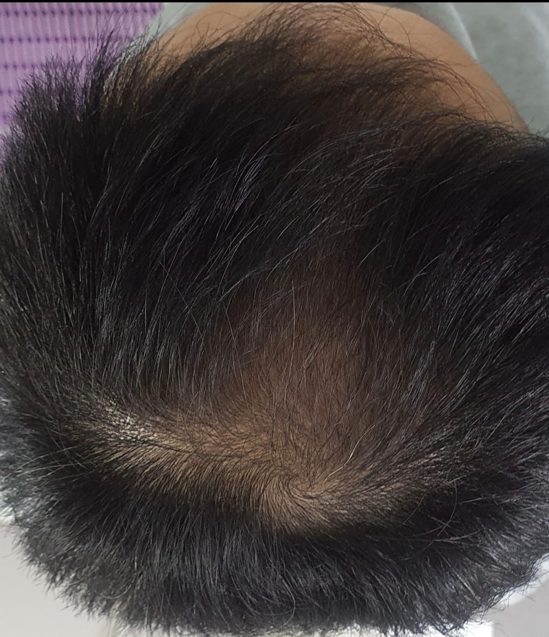 아위스칼프 8주차 후기