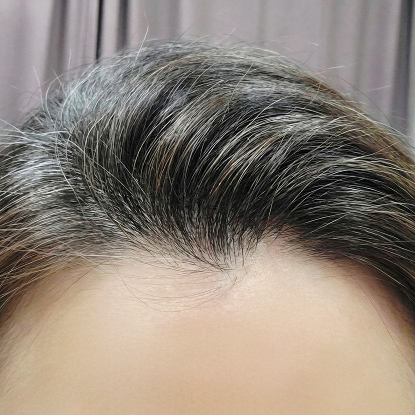 안정되고 있는 두피