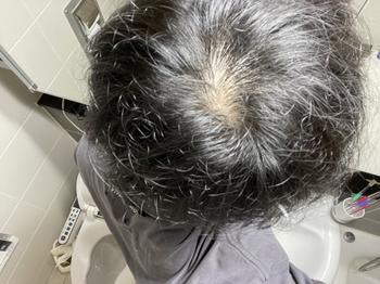 정수리