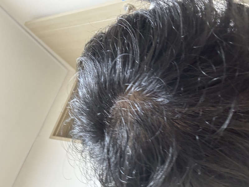 黑森林根动力洗发水第4周！