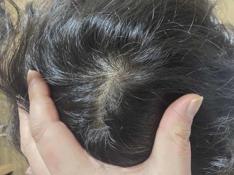 マイノクセル フォアクレンジング 2ヶ月目