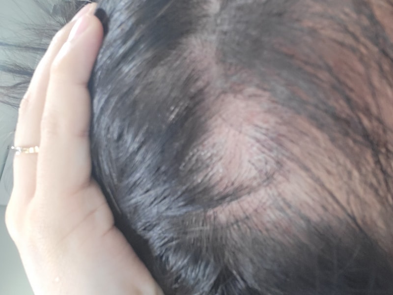 모제림 샴푸 2주차 후기