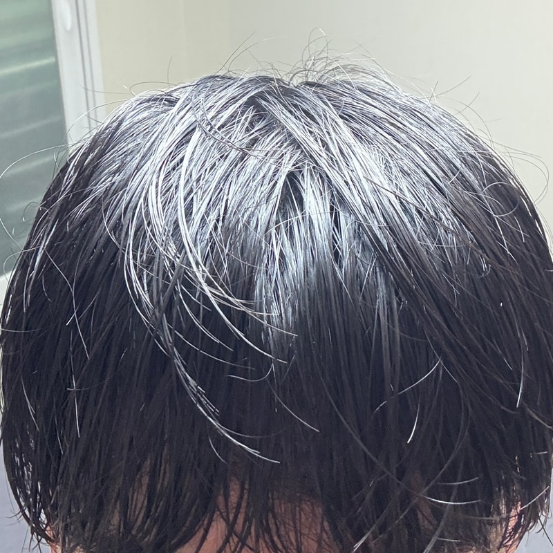 黑森林根动力洗发水 4周后期