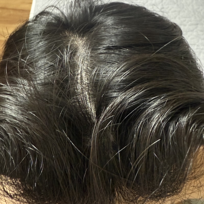 黑森林根动力洗发水 3周后期