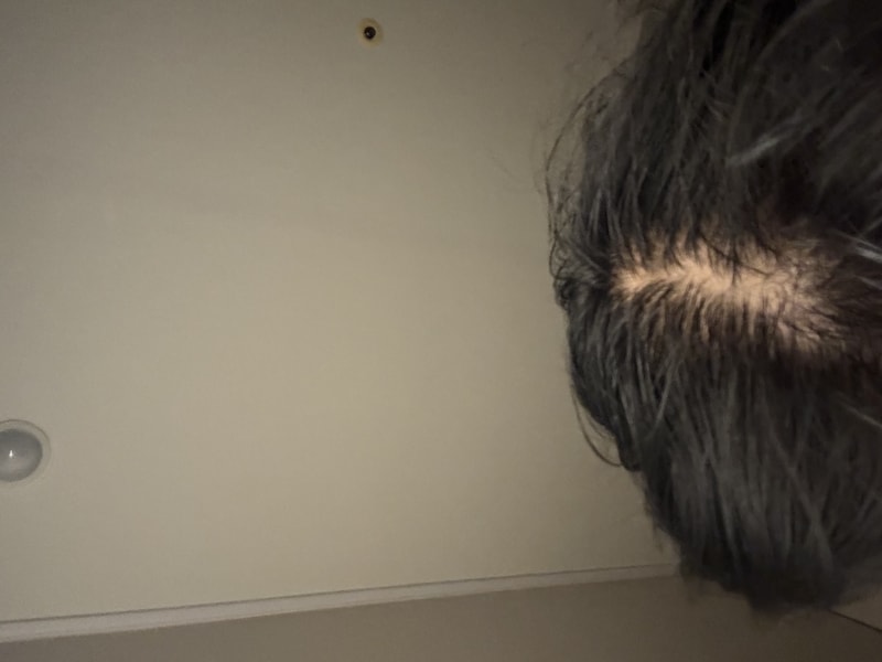 ドクターフォーヘアポリジェンシークニングスカルプセラム1週目~！