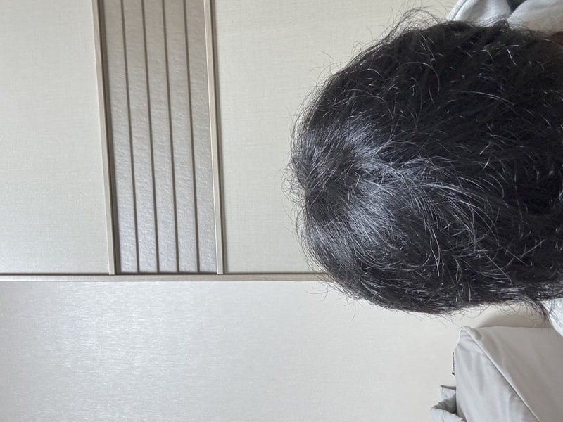 닥터포헤어 폴리젠 씨크닝 스칼프 세럼 3주차~!