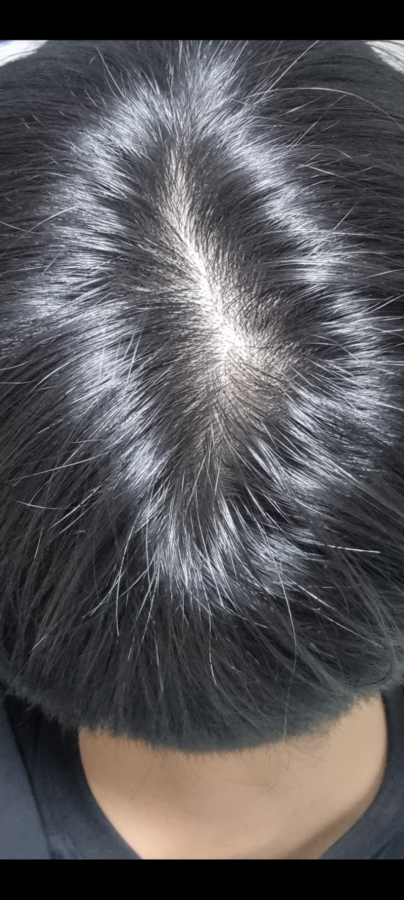 パントモナ ハイパーフォーマー 4週目 体験談