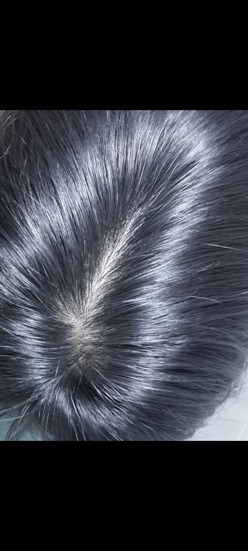 パントモナ ハイパーフォーマー 8週目 服用後の体験談