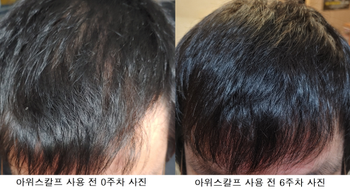 사용 전/후 비교 사진