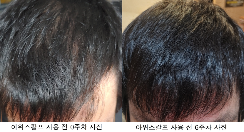 사용 전/후 비교 사진