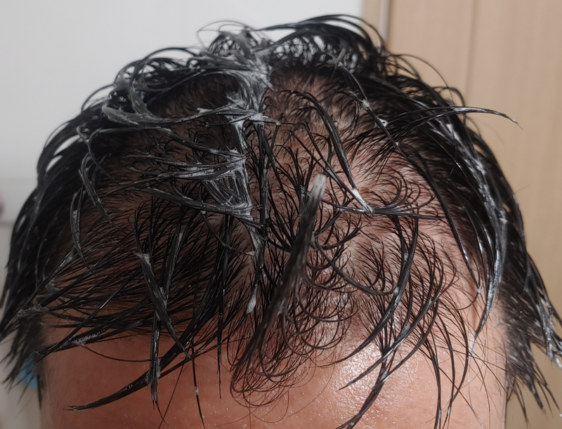 ブラックフォーレ フローズンスケーラー、トリートメント第3週目の使用体験談