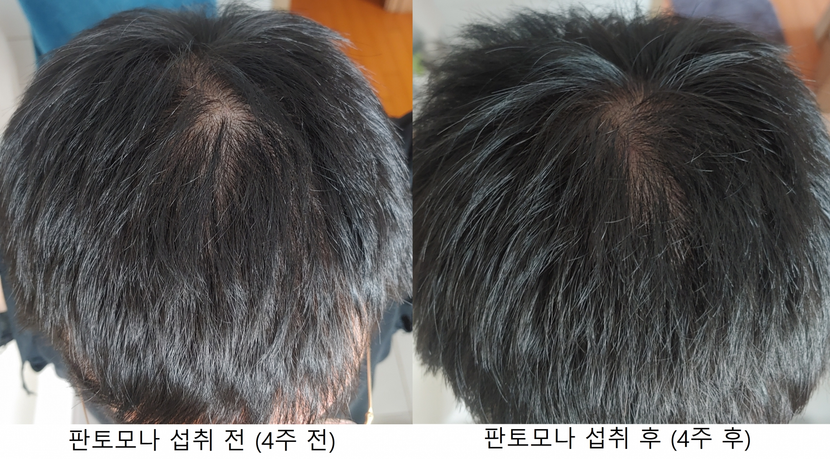 위쪽 두정부 비교사진