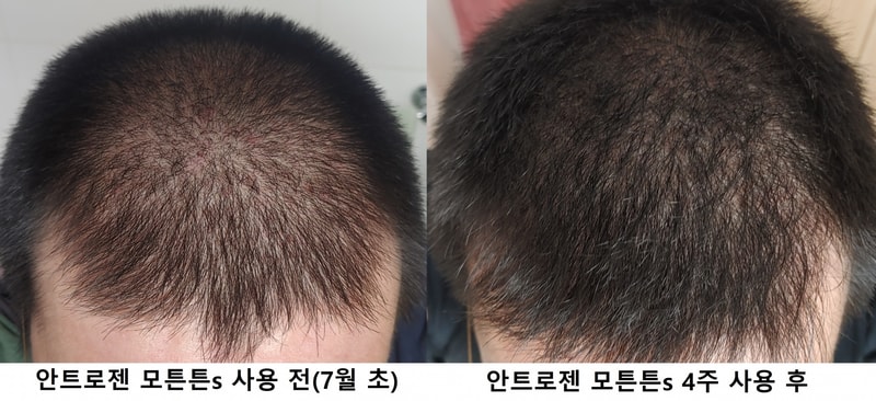 모튼튼s 마지막 4주차 사용후기 (비교사진 포함)