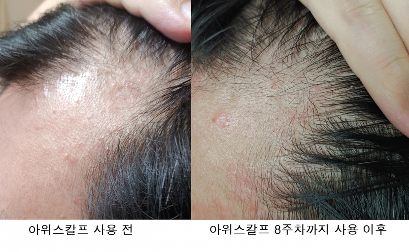 좌측라인 사용 전/후 사진