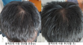 두정부 위쪽 비교사진