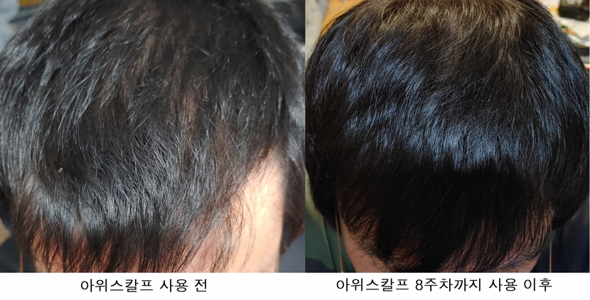 두정부쪽 사용 전/후 사진