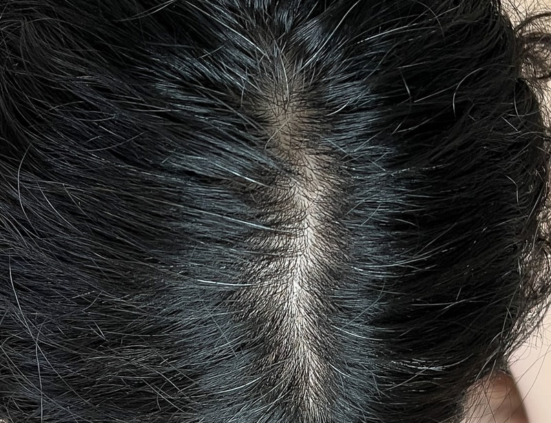 オンユロケア最後の駐車