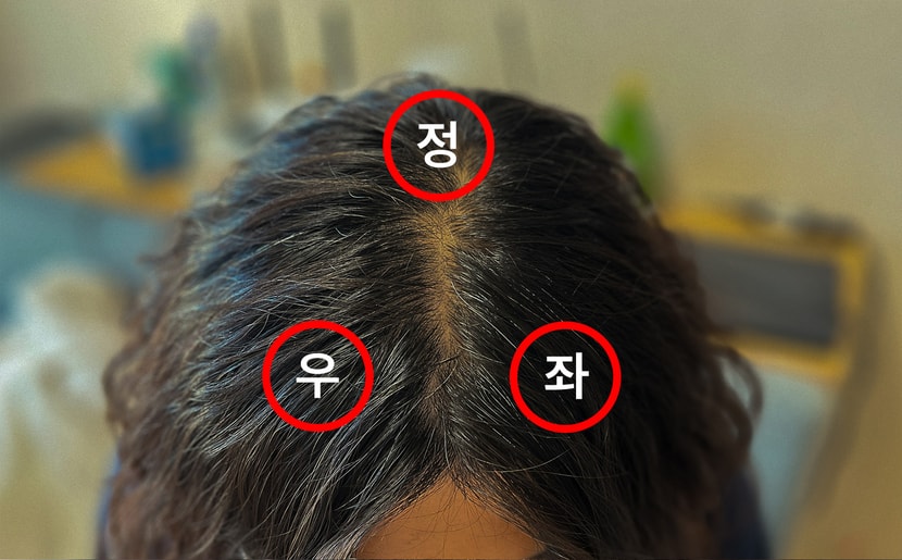 마지막 주차 모발상태, 현미경 관찰 포인트