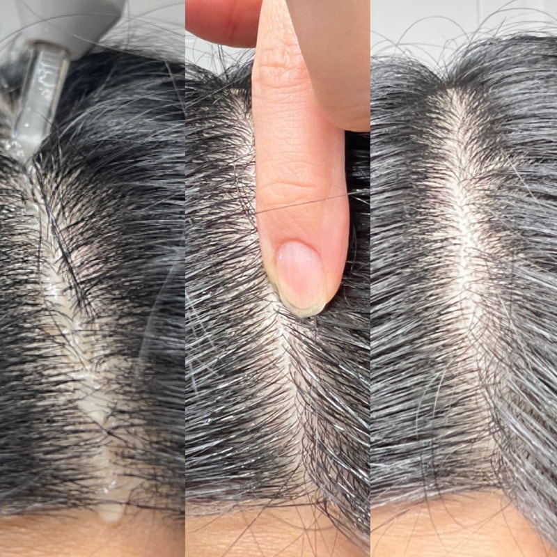 ピーディーアールエヌ リドルショット ヘアアンプル 4週目体験談