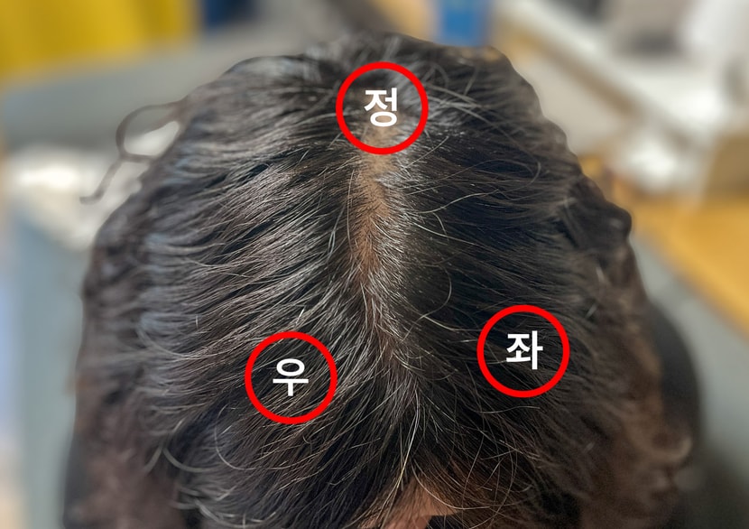 2주차 모발상태 및 현미경 관찰포인트