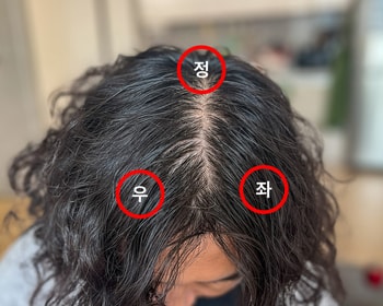 현미경 관찰 포인트