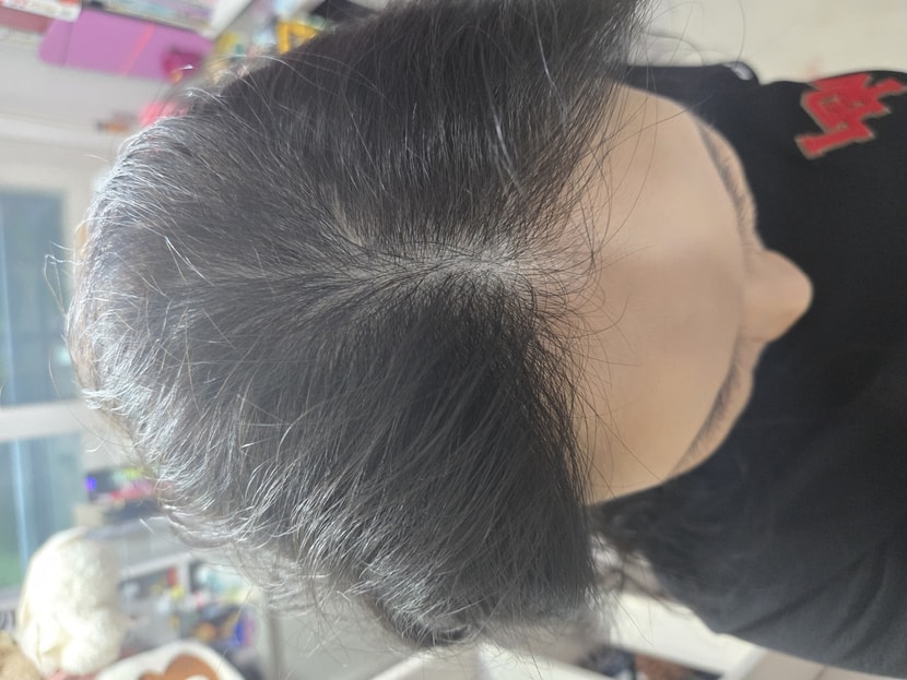 현재 상태