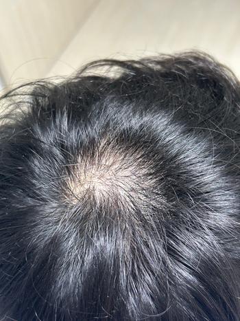 비엘모 4주 사용 사진