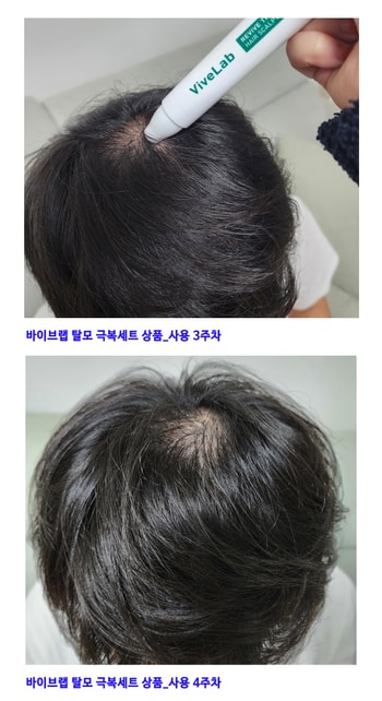 바이브랩 사용 3~4주