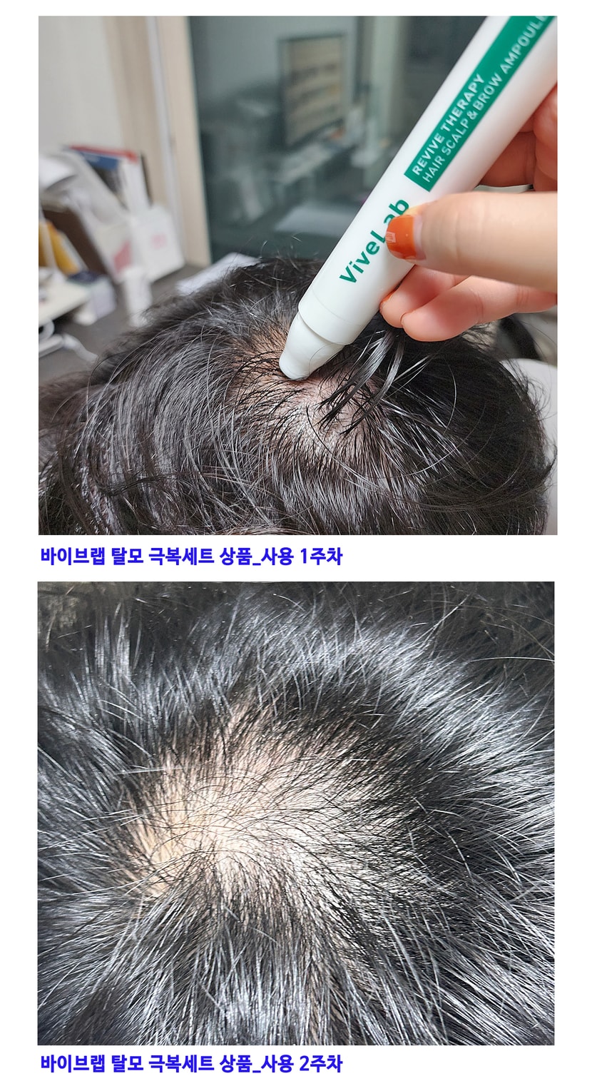 바이브랩 사용 1~2주