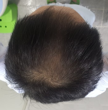 2주 사용 후