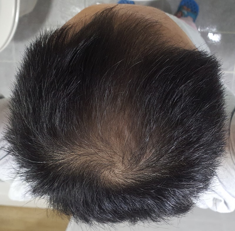 블랙포렛 탄산쿨링 3주차 후기