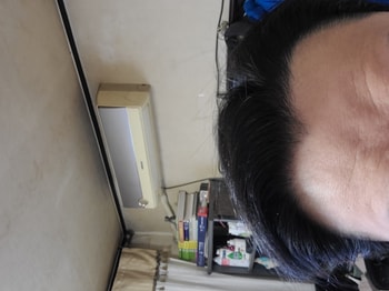 케어끝 드라이후
