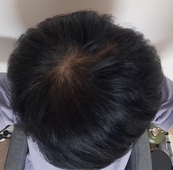 2회 사용