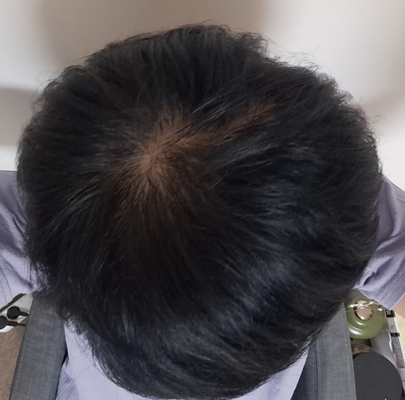 2회 사용