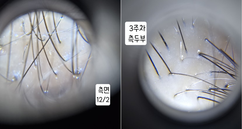 측면 2주 3주차 비교