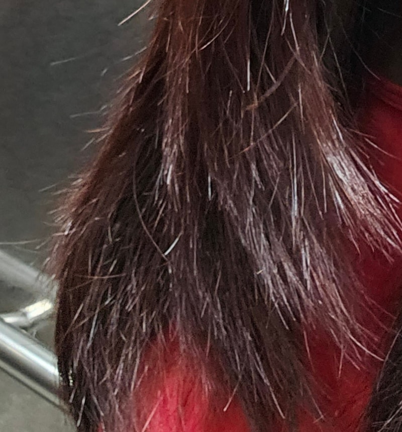 ブラックフォーレ フローズンスケーラー及びトリートメント第4週目の体験談