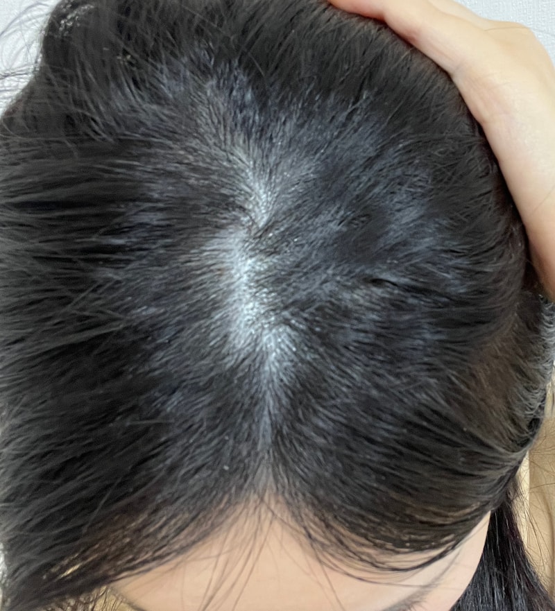 ヘアミラクル1週目の体験談