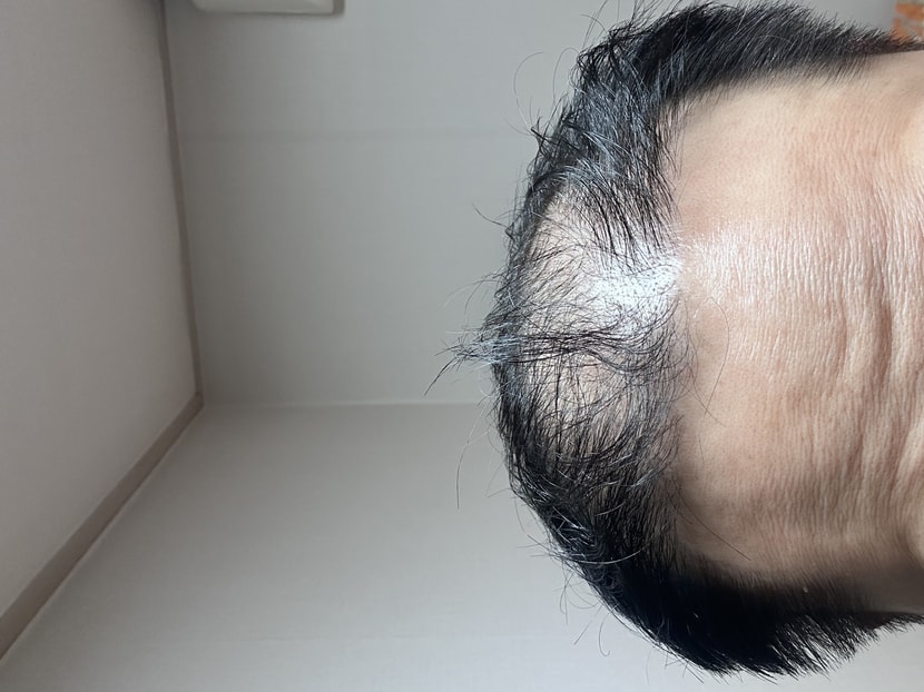 사용 전