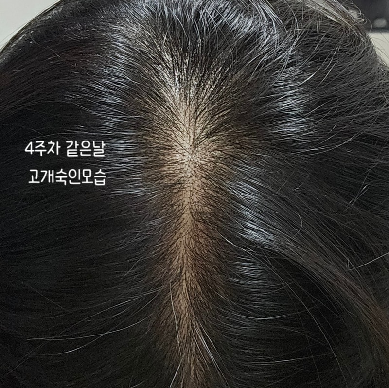 더후  후스파 스칼프 안티에이징 헤어리프팅 샴푸 4주차 후기