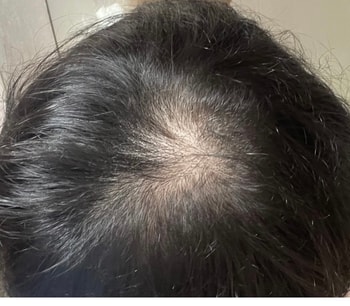제품 사용하기전 고민부위상태