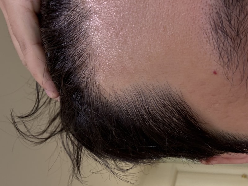 바이오니아 코스메르나 4주차 후기