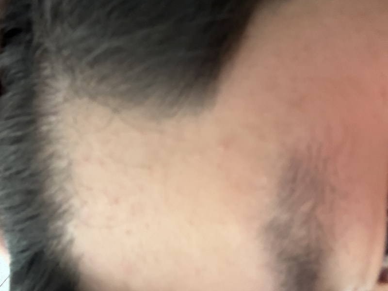 닥터포헤어 폴리젠 씨크닝 스칼프 세럼 4주차 후기