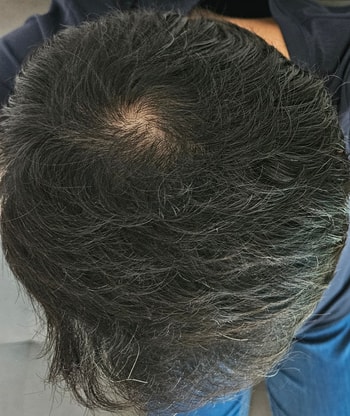 현재 상태