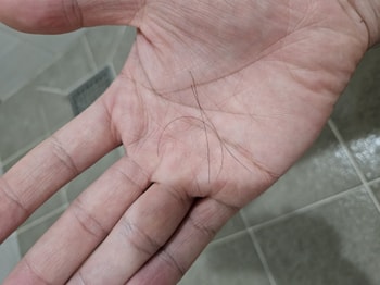 빠지는 머리카락