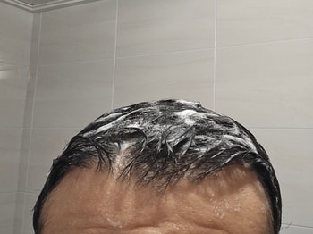 스케일러