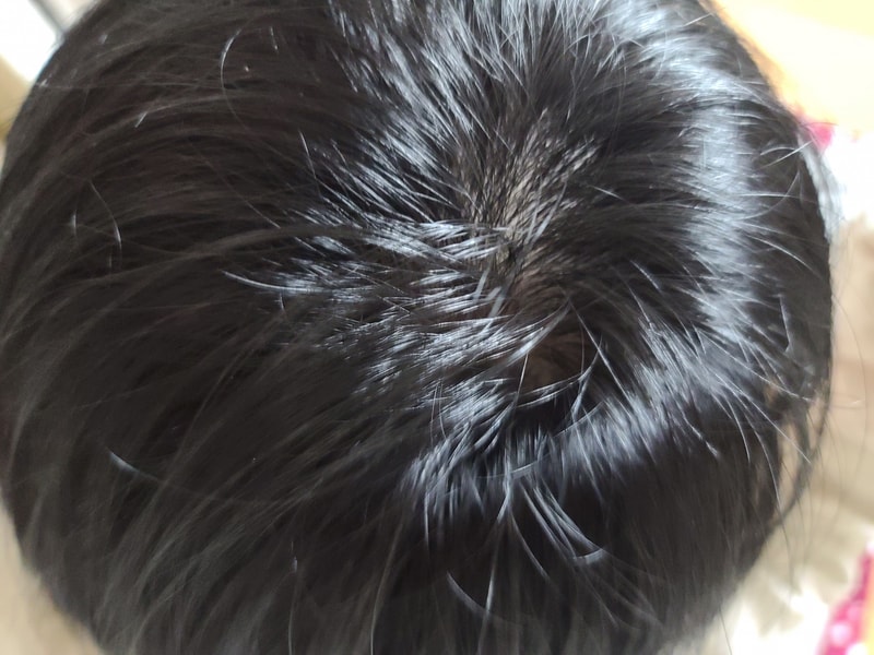 ドクターアドルビオチン2週目の体験談