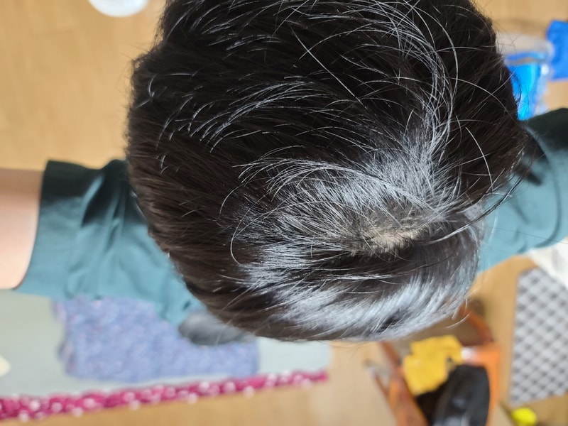 ドクターアドルビオチン4週目の体験談