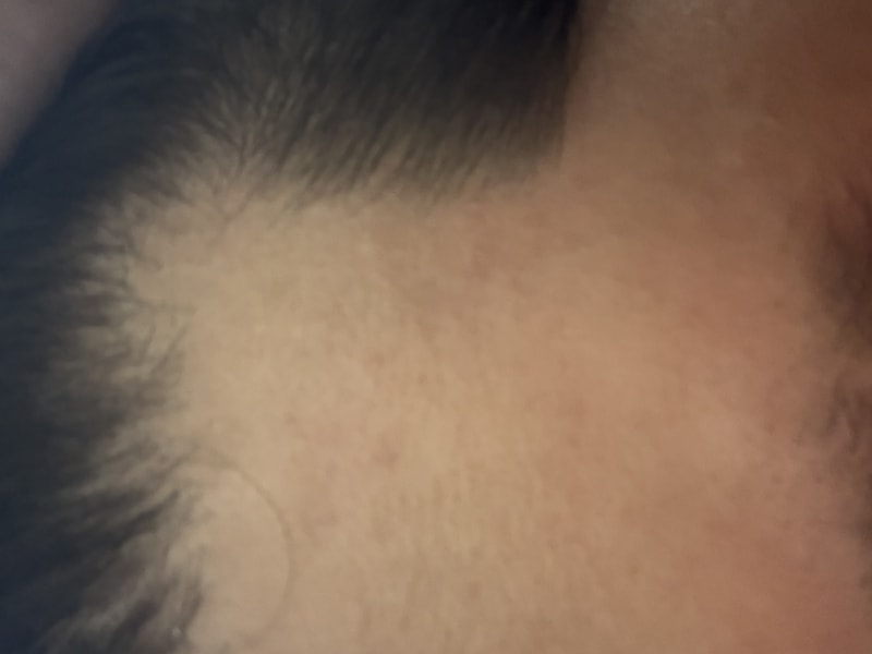 닥터포헤어 폴리젠 씨크닝 스칼프 세럼 3주차 후기입니다.